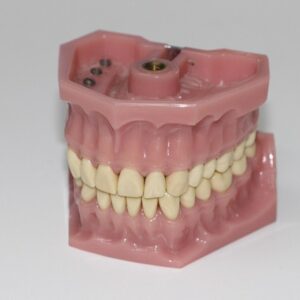 TÉCNICO EM PRÓTESE DENTÁRIA