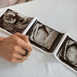 Especialização técnica em neonatologia